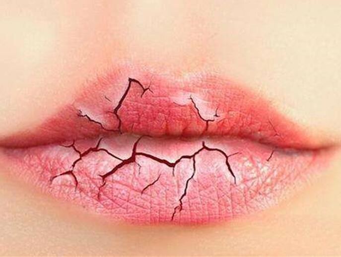 6個(gè)美容技巧，解決秋季嘴唇干燥
