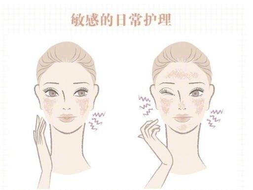 敏感肌保養(yǎng)大全！