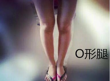 糾正你的腿型！
