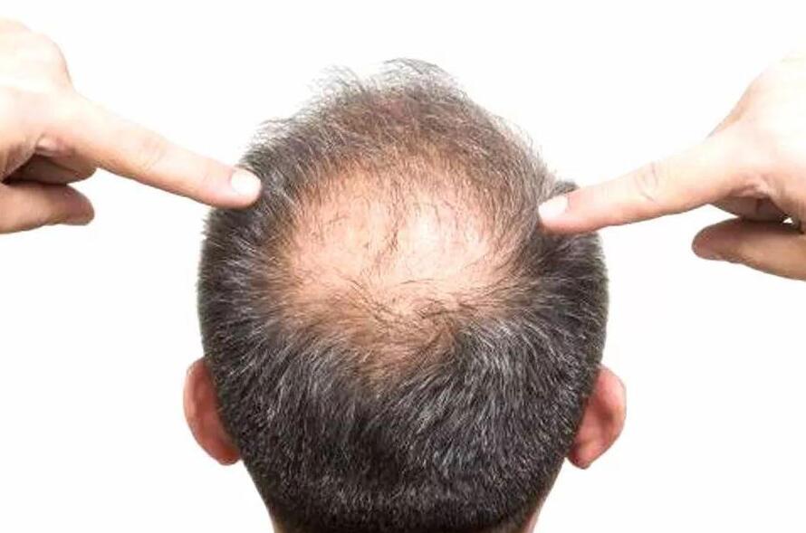 美發(fā)技巧：脫發(fā)可以用吹風機嗎