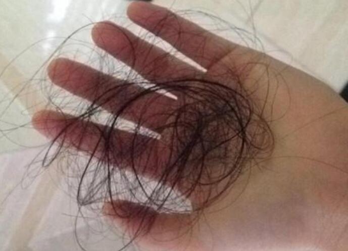 脫發(fā)女孩必備寶典！南寧美發(fā)學校教你