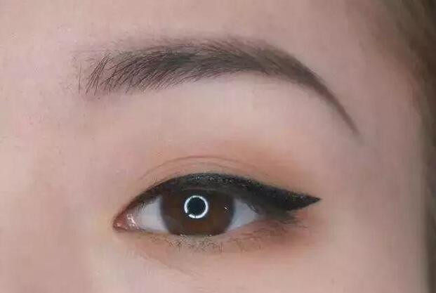 眼尾三角區(qū)怎么處理？