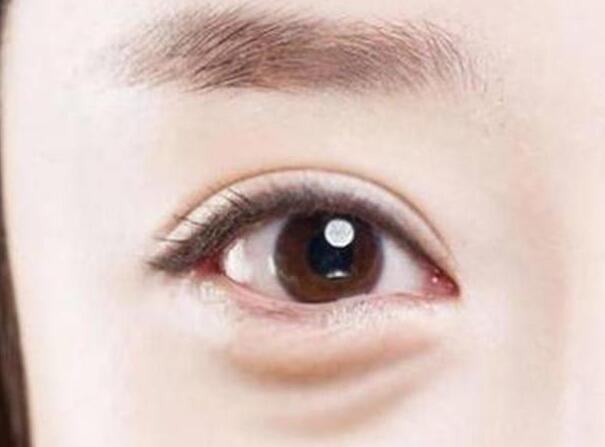 眼袋？淚溝？臥蠶？南寧美容學校教你辨別