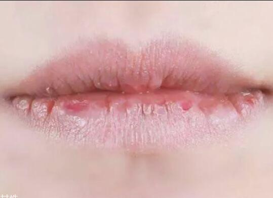 紋唇后嘴巴干燥怎么辦？南寧教紋繡的學(xué)校幫你解決