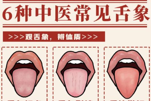 6種常見中醫(yī)舌診判定，快和廣西中醫(yī)美容一起學