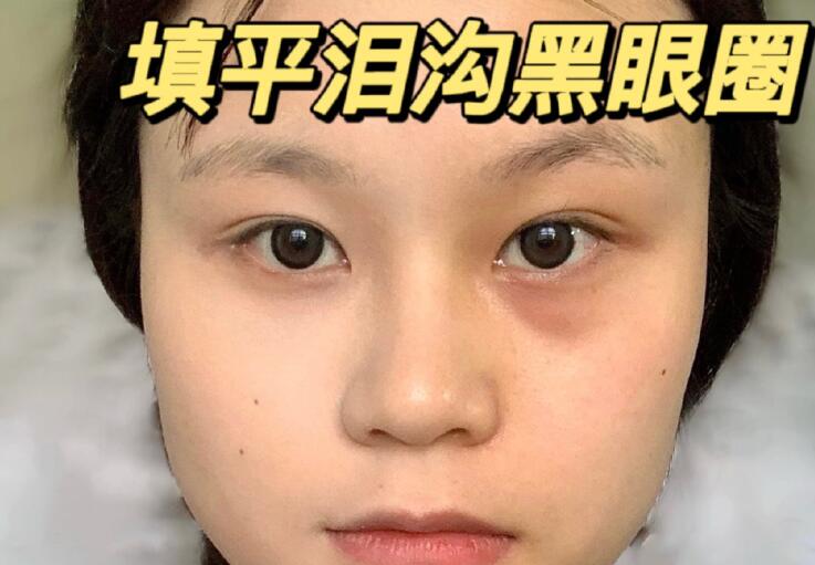 填平淚溝黑眼圈教程，廣西南寧化妝學(xué)校分享