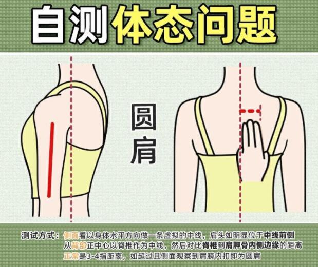 你真的是駝背嗎？廣西美容美體學(xué)校教你自測