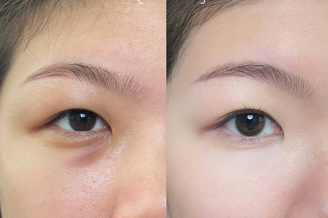 新手遮瑕教程，南寧化妝課程基礎(chǔ)分享