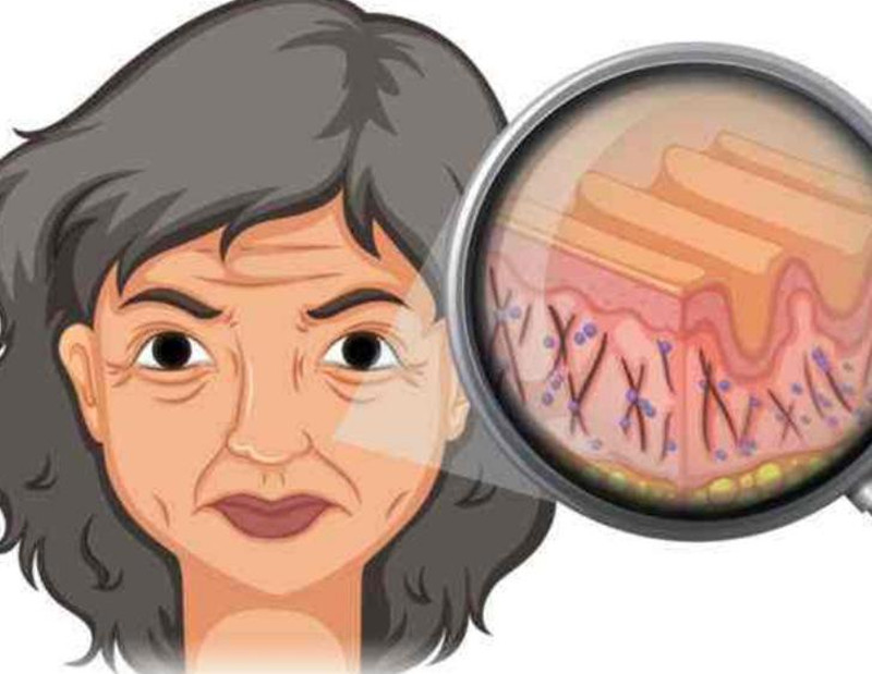 女性如何延緩衰老？南寧皮膚管理培訓班講解