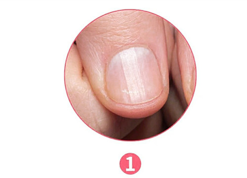 女生氣血不足六大表現(xiàn)，南寧美容養(yǎng)生資訊報(bào)道