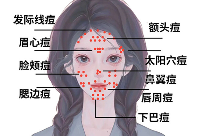 痘（dou）痘修復(fù)攻略,廣西皮膚管理中心分享