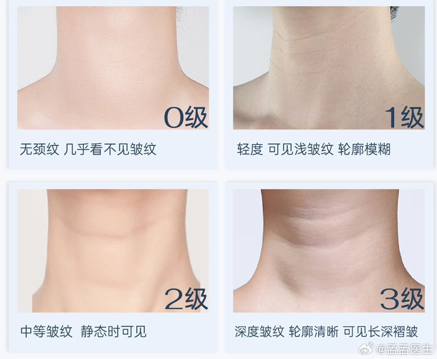 如何緩解頸紋？南寧美體美容管理培訓(xùn)