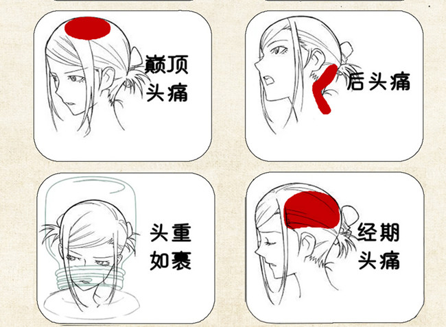 不同頭痛類型經絡護理方法，廣西中醫(yī)美容培訓