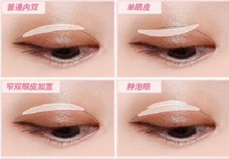 南寧美妝：不同眼型如何貼雙眼皮貼